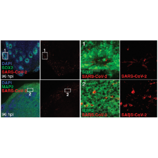 圖3. SARS-CoV-2感染人類腦類器官後，隨著時間延長，SARS-CoV-2陽性細胞增多.png