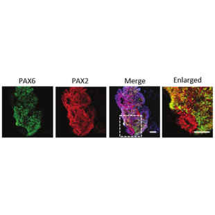 圖2. PAX2（早期發育的前腦、中腦和後腦標記）和PAX6（前腦標記）均有明顯表達.png