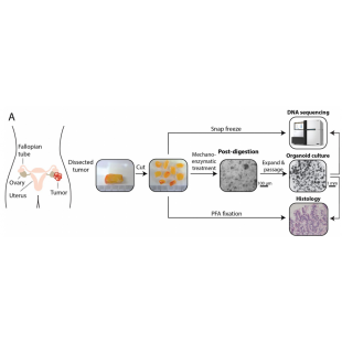 圖1. 病人組織來源的卵巢癌類器官培養方案.png