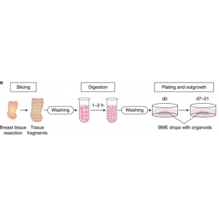圖1. 病人組織來源的乳癌類器官培養方案.png